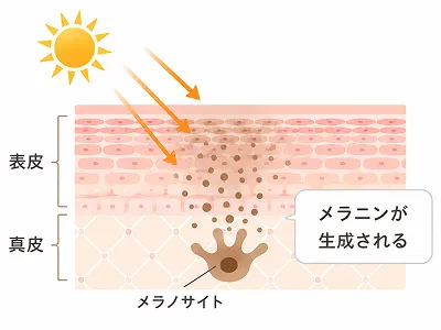 UV rays trigger melanin production by a melanocyte in the epidermis; melanin darkens surrounding skin cells (epidermis/dermis).
