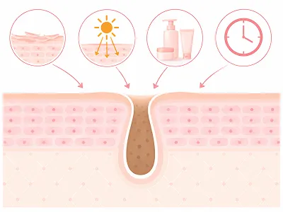 Cross-section of skin showing a pore with a hair follicle and a clogged center; icons above depict sun exposure, sunscreen application, skincare products, and a clock indicating time.