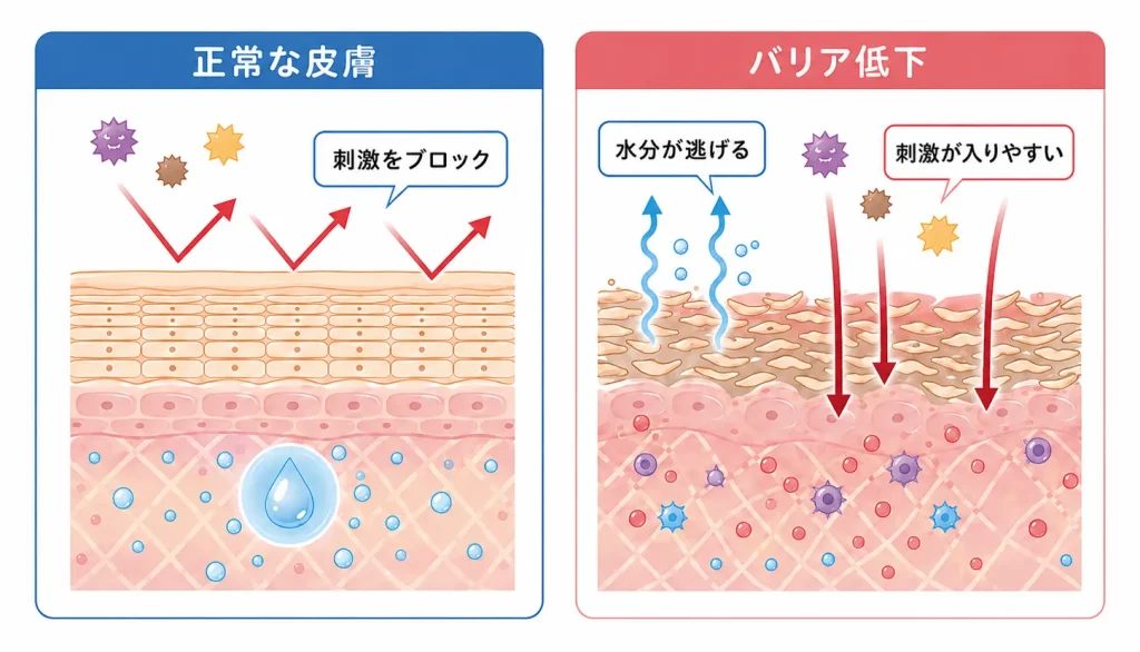 Two panels compare healthy skin repelling irritants (left) with damaged skin allowing irritants to penetrate (right).
