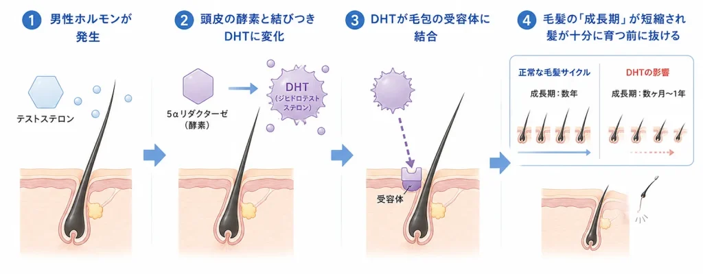 髪の毛の成長サイクルとDHTの影響を図解。テストステロンが5αリダクターゼでDHTに変化し、受容体へ結合して成長期が短縮され抜け毛が進む過程を示す。