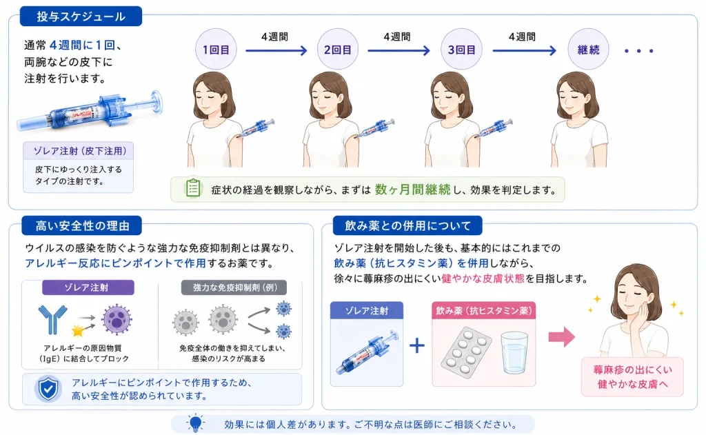 ゾレア注射の具体的治療方法と投与スケジュールを示す日本語の図解。皮下注射を4週間ごとに繰り返す流れが4回分と継続を説明している。
