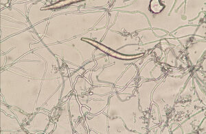 Microscopic view of tangled fungal hyphae with two thicker curved hyphae crossing the field